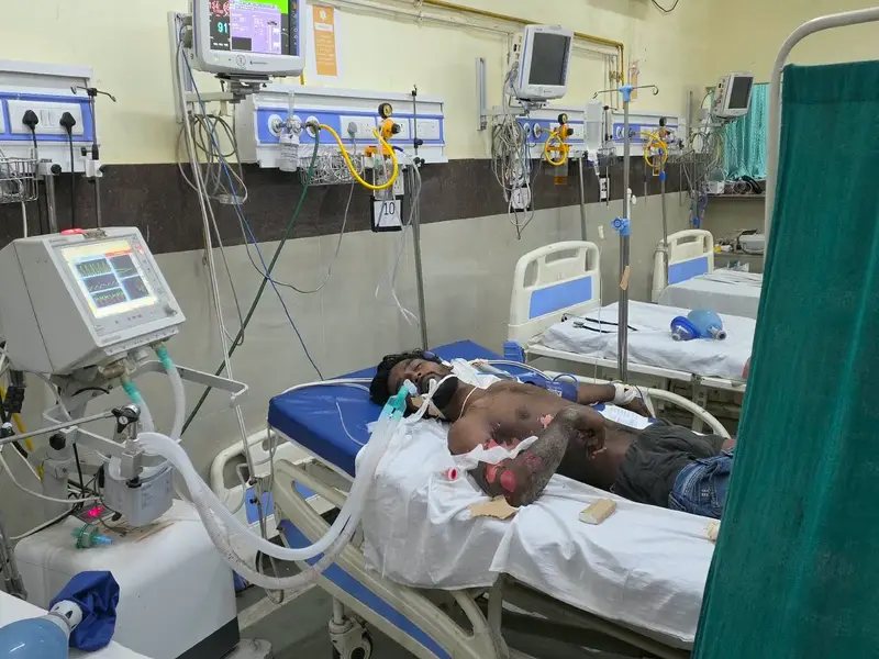 जन्माष्टमी की तैयारी के दौरान बड़ा हादसा: हाईटेंशन तार की चपेट में आया युवक, CIMS में इलाज जारी